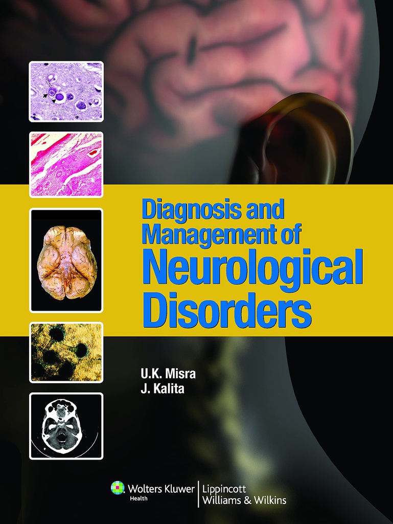 Neurology Secrets: 1st SAE