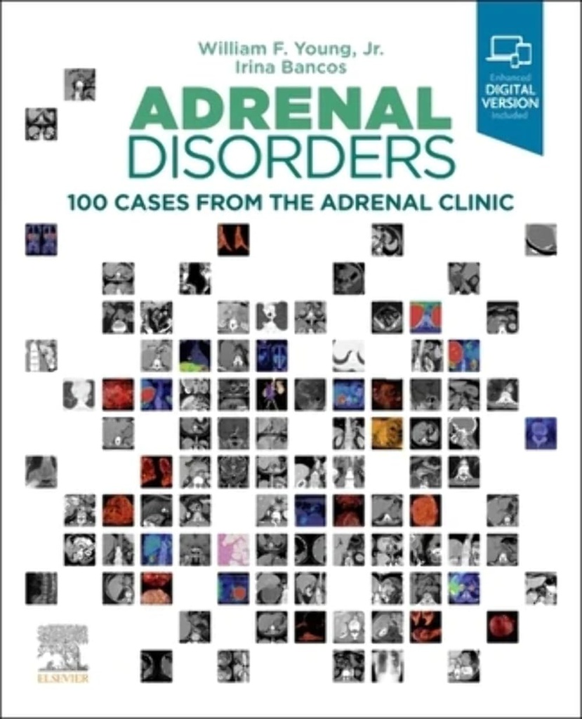 Wheeler's Dental Anatomy, Physiology and Occlusion, 2nd SAE