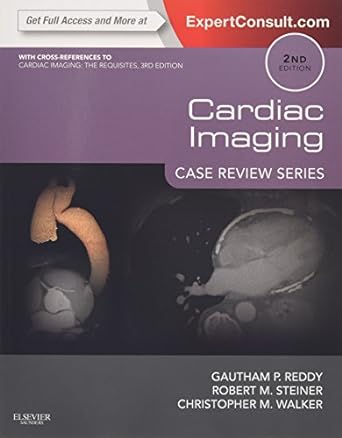 Wallach’s Interpretation of Diagnostic Tests, SAE