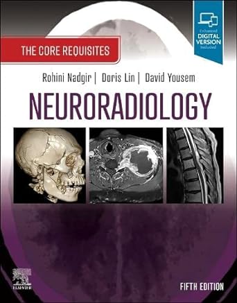 Lewis's Medical-Surgical Nursing: Assessment and Management of Clinical Problems, Single VOL 12ed
