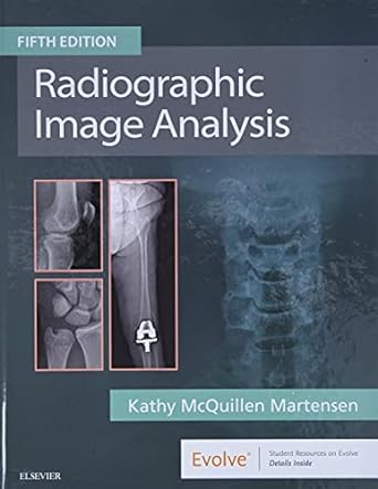 Radiographic Image Analysis: 5ed