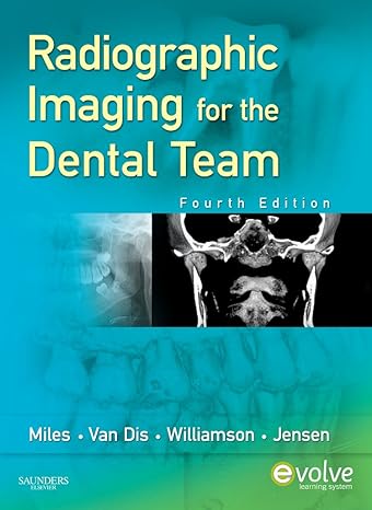 Ocular Disease: Mechanisms and Management: Expert Consult - Online and Print 1ed