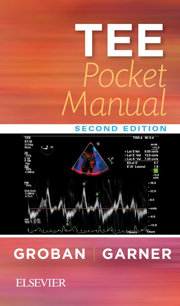 TEE Pocket Manual: 2ed