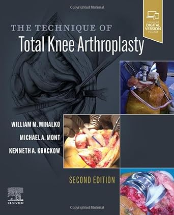 The Technique of Total Knee Arthroplasty: 2ed