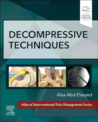 Calipered Kinematically aligned Total Knee Arthroplasty: Theory, Surgical Techniques and Perspectives 1ed