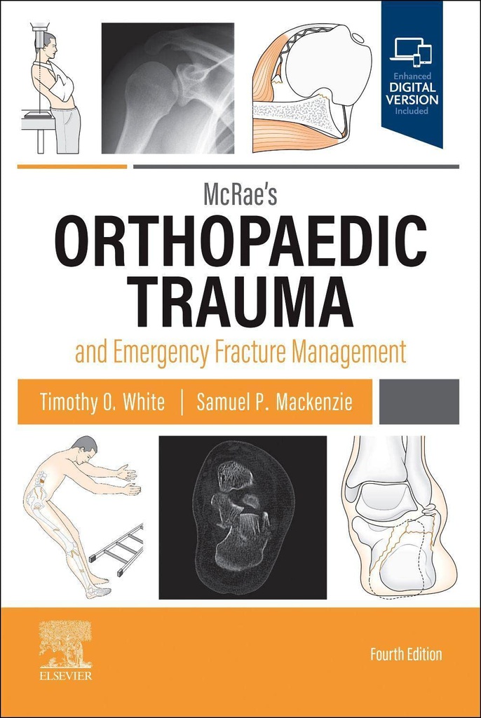 Handbook of Anesthesia: 5ed