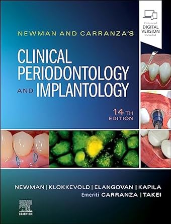 Newman and Carranza's Clinical Periodontology and Implantology: 14ed