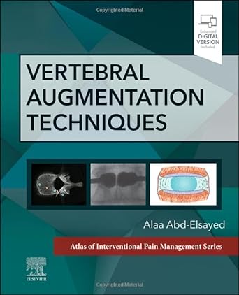 Vertebral Augmentation Techniques: 1ed