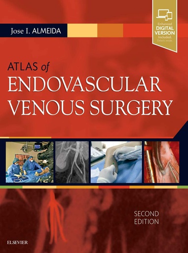 [B9780323511391] Atlas of Endovascular Venous Surgery: 2ed