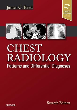 [B9780323498319] Abdominal Ultrasound: How, Why and When 4ed