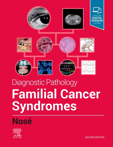 [B9780323712040] Diagnostic Pathology: Familial Cancer Syndromes, 2/e