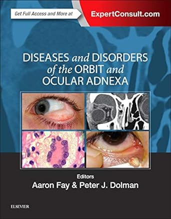 [B9780323377232] Clinical Atlas of Anterior Segment OCT: Optical Coherence Tomography: 1ed