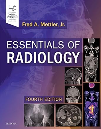 [B9780323508872] Essentials of Radiology: Common Indications and Interpretation 4ed