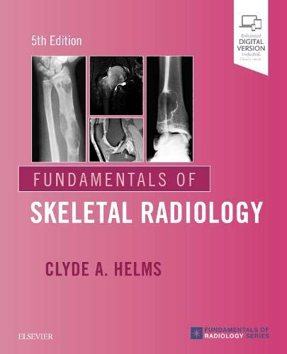 [B9780323611657] Diagnosis and Treatment of Movement Impairment Syndromes: 1ed