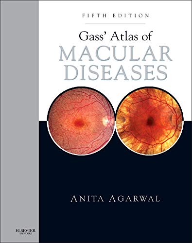 [B9781437715804] Diagnostic Atlas of Renal Pathology: 4ed