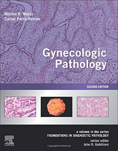 [B9780323359092] Dorfman and Czerniak's Bone Tumors: 2ed
