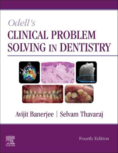 [B9780702077005] Odell's Clinical Problem Solving in Dentistry: 4ed