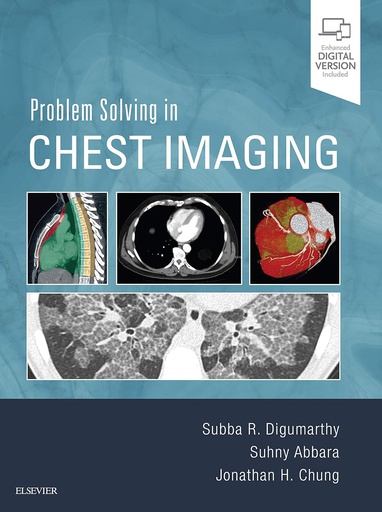 [B9780323041324] Nuclear Cardiology and Multimodal Cardiovascular Imaging: A Companion to Braunwald's Heart Disease 1ed