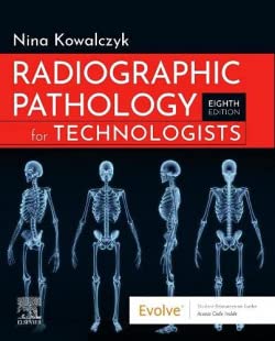 [B9780323791298] Ocular Pathology: 9ed
