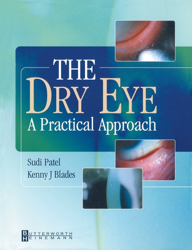 [B9780750649780] The Dry Eye: A Practical Approach 1ed