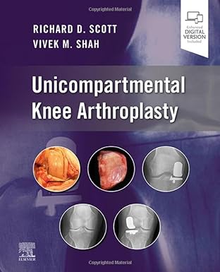 [B9780323790109] Specialty Imaging: Acute and Chronic Pain Intervention: 1ed