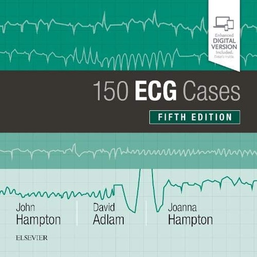 [B9780702074585] 150 ECG Cases: 5ed