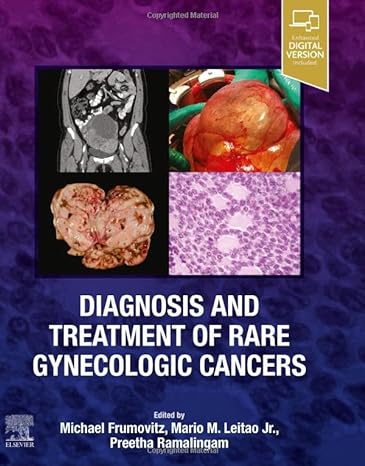 [B9780323829380] Diagnosis and Treatment of Rare Gynecologic Cancers: 1ed