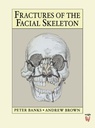 Fractures of the Facial Skeleton: 1ed