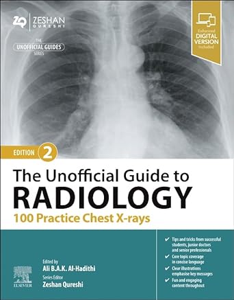 [B9780443109171] Shoulder Arthroplasty: 2ed