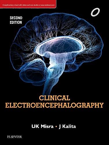 [B9788131252956] Clinical Electroencephalography, 2e